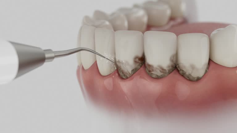 Reliable Dental contractor in Westminster, TX by Smile Center Dentistry